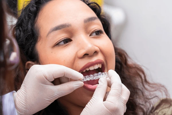 Invisalign South Edmonton