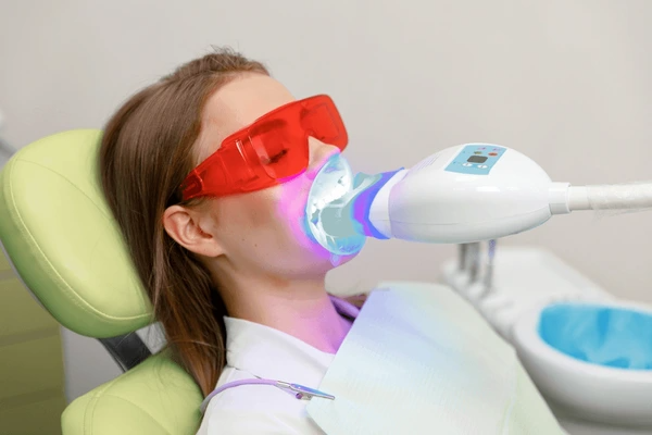 teeth whitening south edmonton