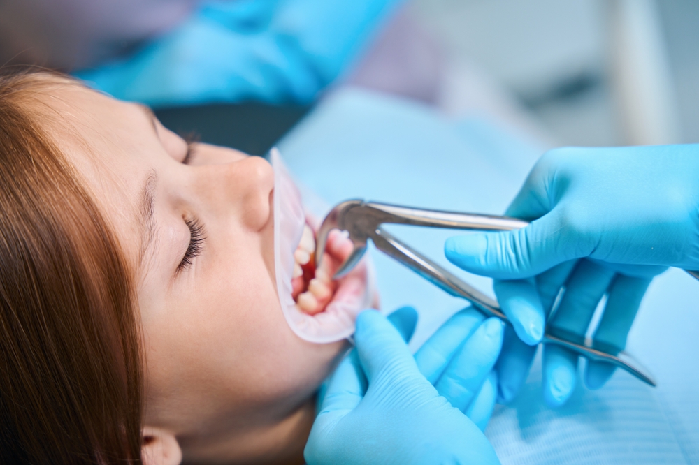 tooth extraction in south edmonton