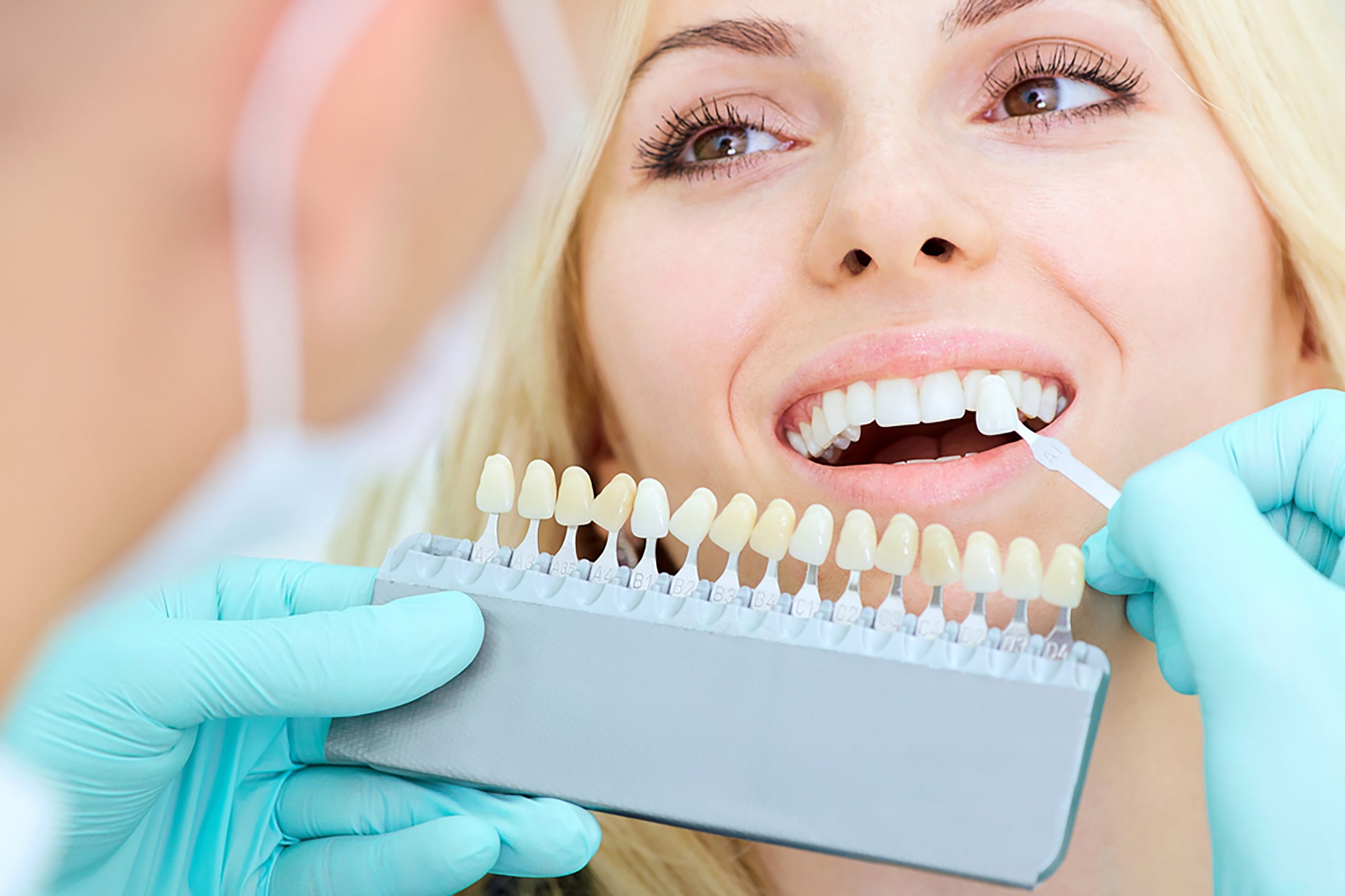 Whitening teeth Teeth Whitening