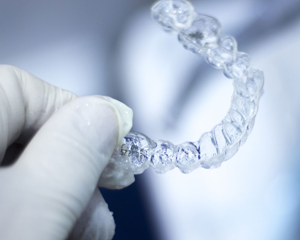 invisalign in South Edmonton