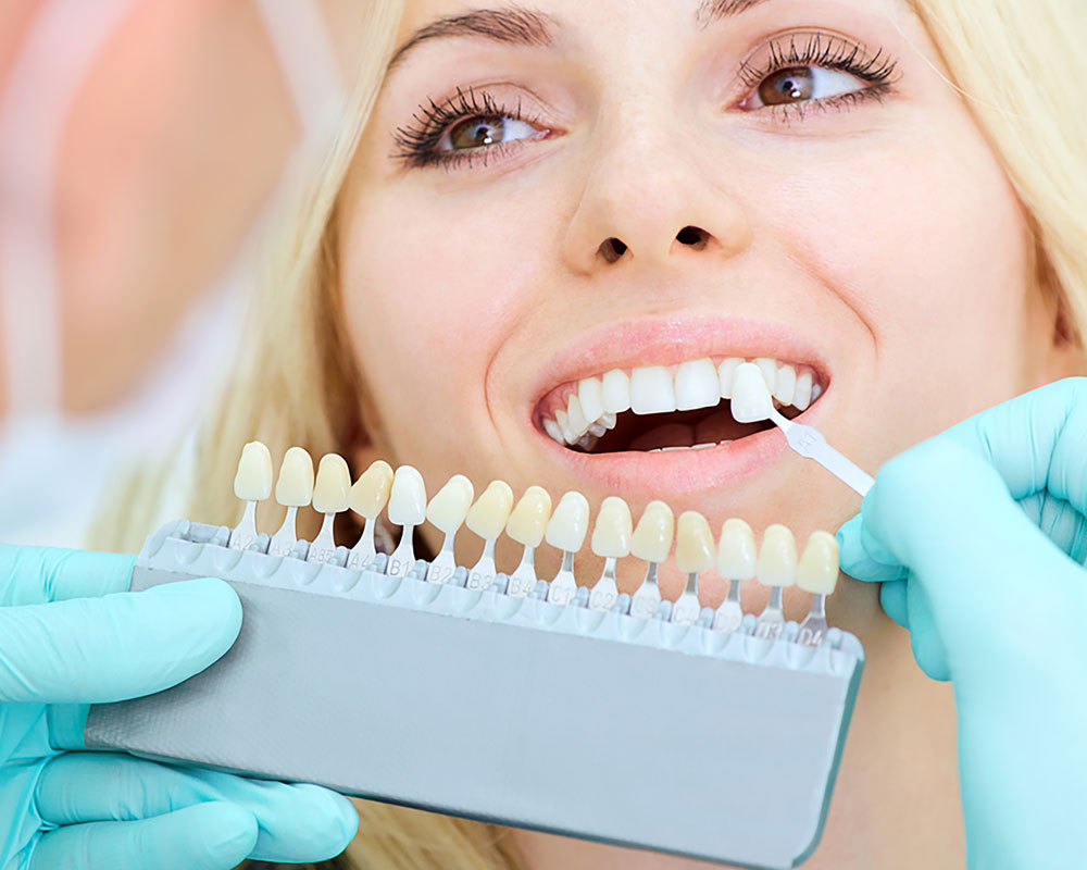 teeth whitening in South Edmonton