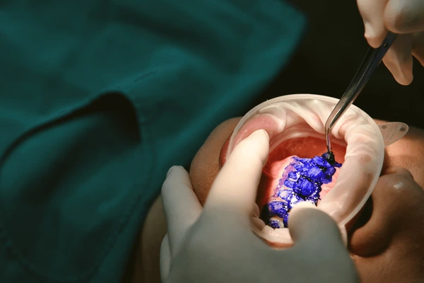 guided biofilm therapy near you